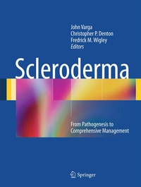 Enlarge image Cover: Scleroderma - Springer