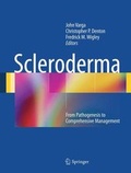 Cover: Scleroderma - Springer
