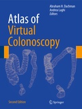 Cover: Atlas of Virtual Colonoscopy - Springer