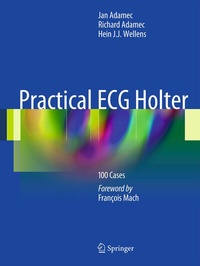 Enlarge image Cover: Practical ECG Holter - Springer