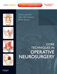 Enlarge image Cover: Core Techniques in Operative Neurosurgery - Saunders