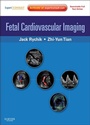 Cover: Fetal Cardiovascular Imaging E-Book - Saunders