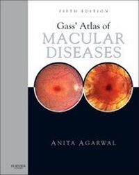 Abbildung von: Gass' Atlas of Macular Diseases - Saunders