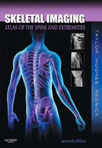 Abbildung von: Skeletal Imaging - Saunders