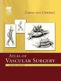 Cover: Atlas Of Vascular Surgery - Paperback Edition - Churchill Livingstone Inc