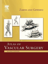 Enlarge image Cover: Atlas Of Vascular Surgery - Paperback Edition - Churchill Livingstone Inc
