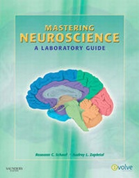Abbildung von: Mastering Neuroscience - Saunders