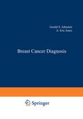 Cover: Breast Cancer Diagnosis - Springer