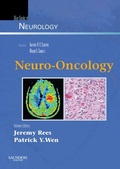 Cover: Neuro-Oncology - Saunders