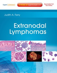 Enlarge image Cover: Extranodal Lymphomas E-Book - Saunders