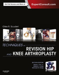Abbildung von: Techniques in Revision Hip and Knee Arthroplasty E-Book - Saunders
