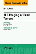 Cover: PET Imaging of Brain Tumors, An Issue of PET Clinics - Elsevier