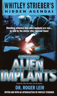 Enlarge image Cover: Casebook: Alien Implants - Dell