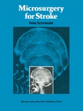 Cover: Microsurgery for Stroke - Springer