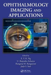 Enlarge image Cover: Ophthalmological Imaging and Applications - CRC Press