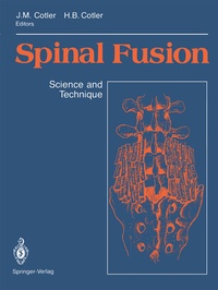Enlarge image Cover: Spinal Fusion - Springer