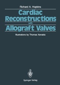 Bild: Cardiac Reconstructions with Allograft Valves - Springer