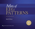 Cover: Atlas of EEG Patterns - Lippincott Williams and Wilkins