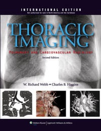 Enlarge image Cover: Thoracic Imaging - Lippincott Williams and Wilkins