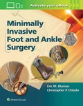 Cover: Minimally Invasive Foot & Ankle Surgery - Lippincott Williams and Wilkins