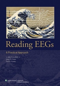Abbildung von: Reading EEGs: A Practical Approach - WOLTERS KLUWER HEALTH