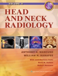 Abbildung von: Head and Neck Radiology - WOLTERS KLUWER HEALTH