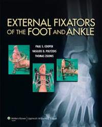 Abbildung von: External Fixators of the Foot and Ankle - Lippincott Williams and Wilkins