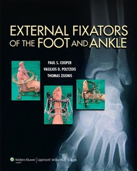 Enlarge image Cover: External Fixators of the Foot and Ankle - Lippincott Williams and Wilkins