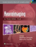 Cover: Neuroimaging: A Teaching File - Lippincott Williams and Wilkins