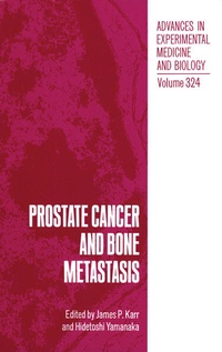 Enlarge image Cover: Prostate Cancer and Bone Metastasis - Springer
