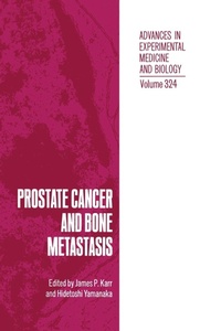 Enlarge image Cover: Prostate Cancer and Bone Metastasis - Kluwer Academic / Plenum Publishers