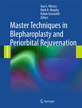 Cover: Master Techniques in Blepharoplasty and Periorbital Rejuvenation - Springer