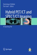 Cover: Hybrid PET/CT and SPECT/CT Imaging - Springer