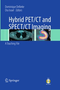 Enlarge image Cover: Hybrid PET/CT and SPECT/CT Imaging - Springer