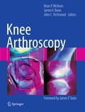 Cover: Knee Arthroscopy - Springer