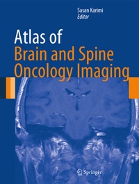 Bild: Atlas of Brain and Spine Oncology Imaging - Springer