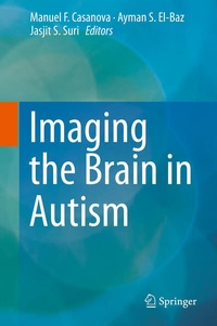 Enlarge image Cover: Imaging the Brain in Autism - Springer