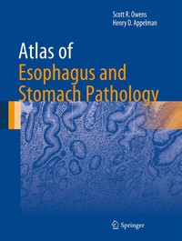 Abbildung von: Atlas of Esophagus and Stomach Pathology - Springer