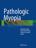 Cover: Pathologic Myopia - Springer