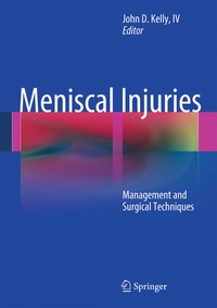 Abbildung von: Meniscal Injuries - Springer