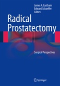 Cover: Radical Prostatectomy - Springer