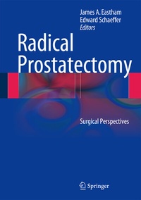 Enlarge image Cover: Radical Prostatectomy - Springer