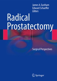 Enlarge image Cover: Radical Prostatectomy - Springer
