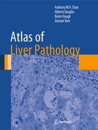 Abbildung von: Atlas of Liver Pathology - Springer