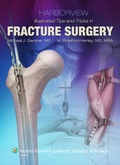 Cover: Harborview Illustrated Tips and Tricks in Fracture Surgery - Lippincott Williams and Wilkins