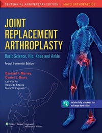 Enlarge image Cover: Joint Replacement Arthroplasty - Lippincott Williams and Wilkins