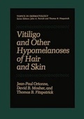 Cover: Vitiligo and Other Hypomelanoses of Hair and Skin - Kluwer Academic / Plenum Publishers