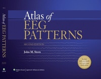Abbildung von: Atlas of EEG Patterns - WOLTERS KLUWER HEALTH
