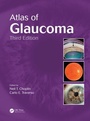 Cover: Atlas of Glaucoma - CRC Press