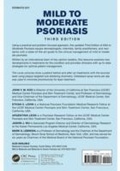 Cover: Mild to Moderate Psoriasis - CRC Press